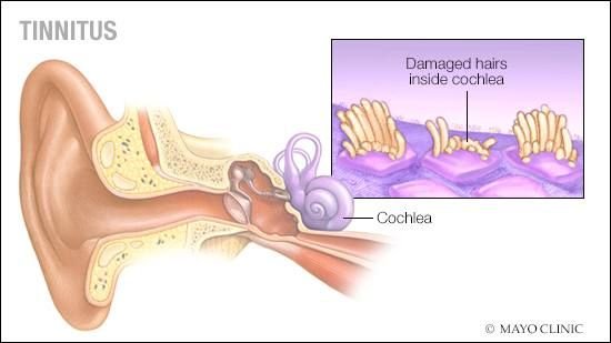 Best Tinnitus Treatment in Lahore | Audiometry Test Price